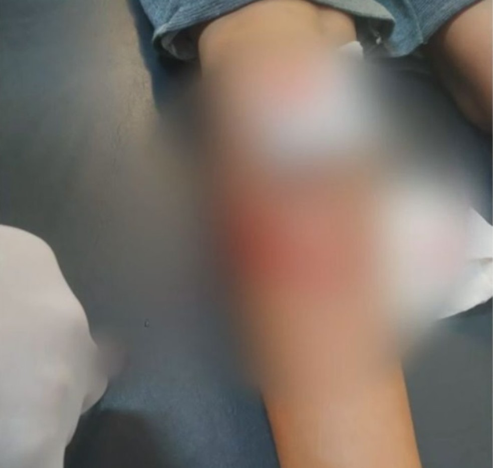 Menino foi atingido por um tiro na perna em Jacobina, no norte do estado — Foto: Reprodução/Jacobina Notícias