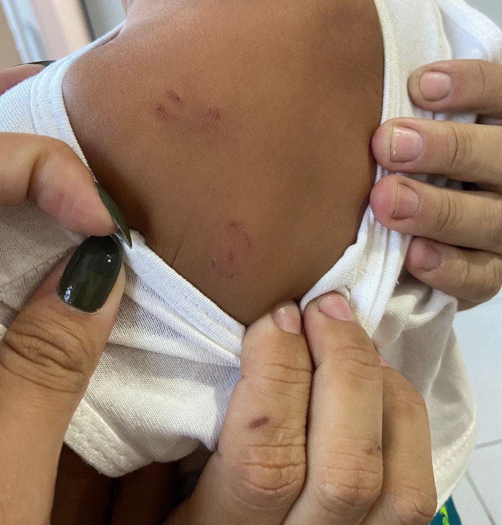 Bebê teve 9 mordidas em creche do Rio — Foto: Arquivo pessoal