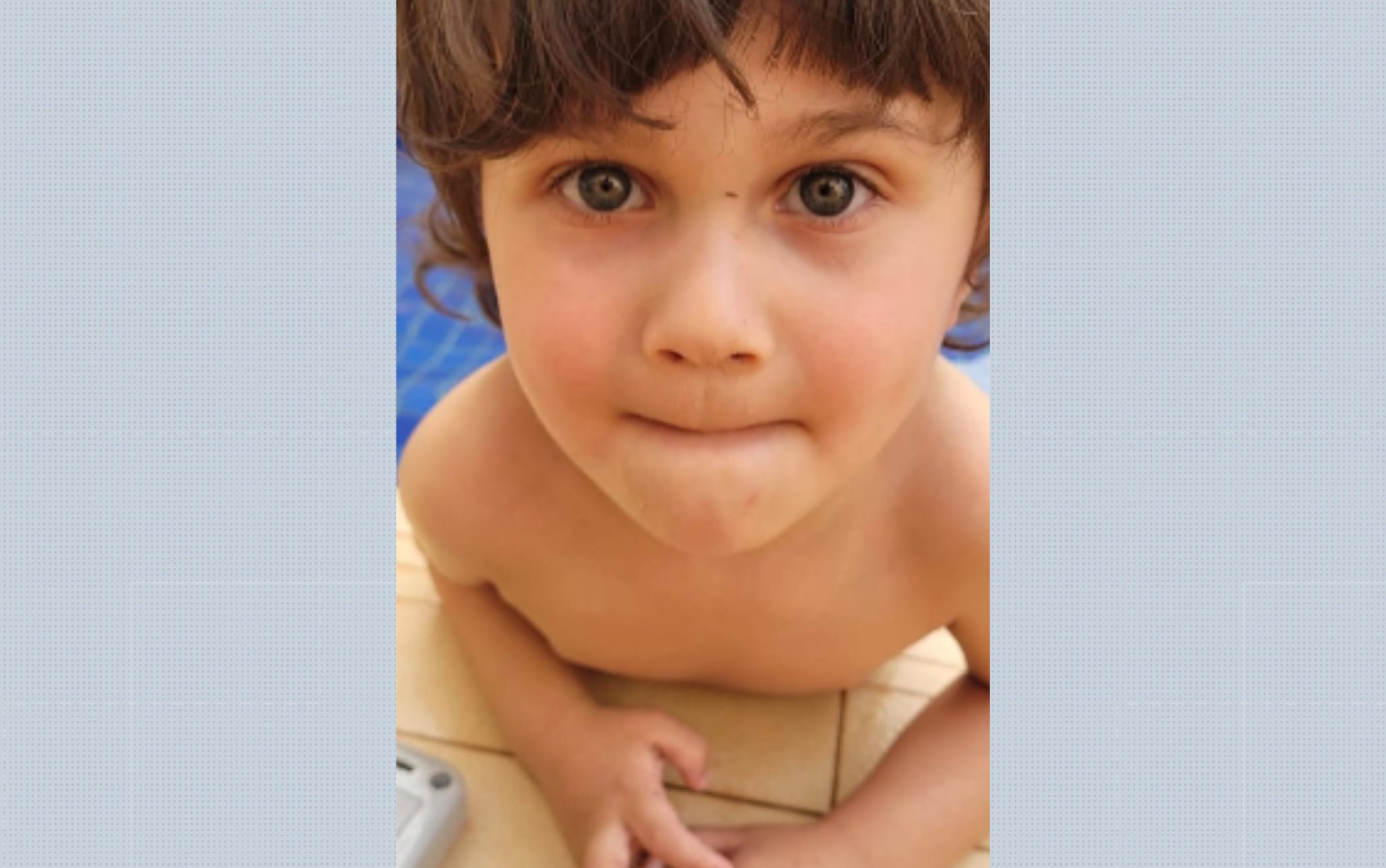 Menino de 4 anos que sobreviveu à queda do 10º andar de prédio no interior de SP quebrou as duas pernas