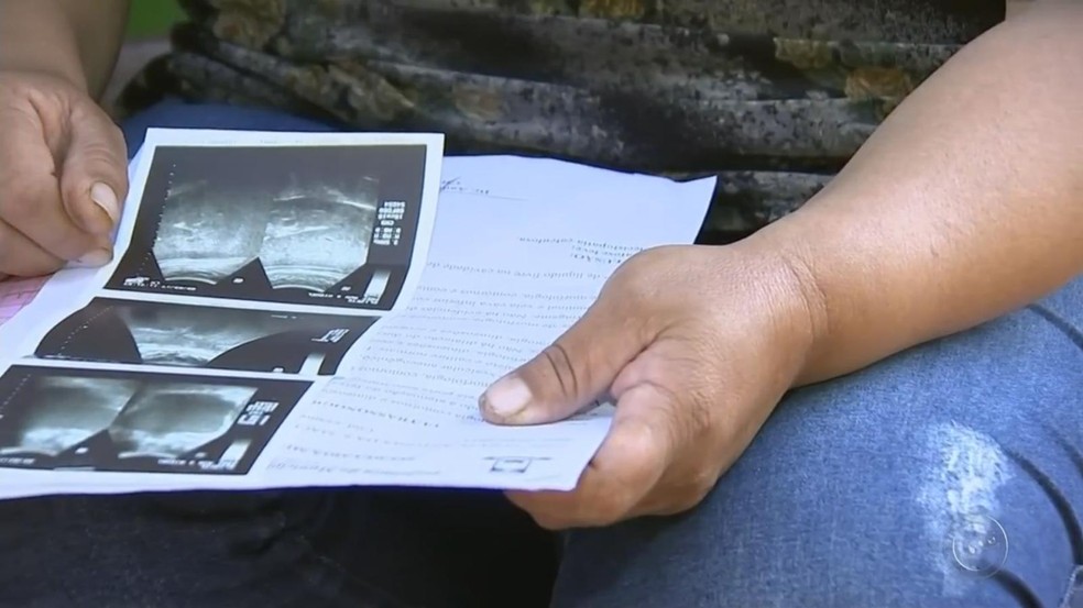 Pacientes aguardam há anos por uma cirurgia eletiva em Itapetininga — Foto: Reprodução/TV TEM