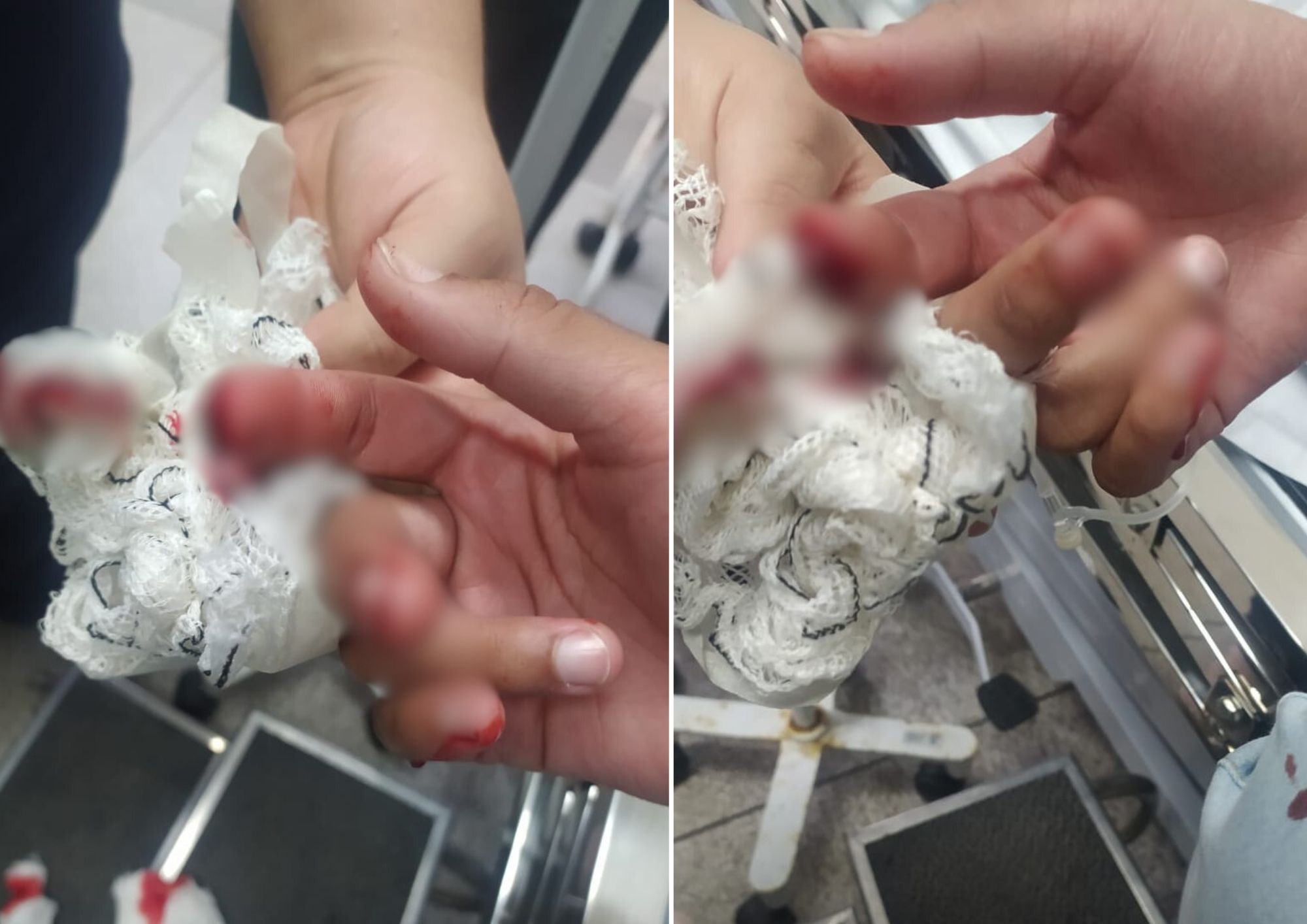 Adolescente tem dedo amputado em escola de SP
