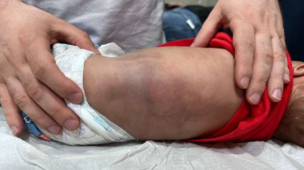 Pai bateu na crian&ccedil;a porque ela n&atilde;o parava de chorar &mdash; Foto: Minist&eacute;rio P&uacute;blico do Paran&aacute;