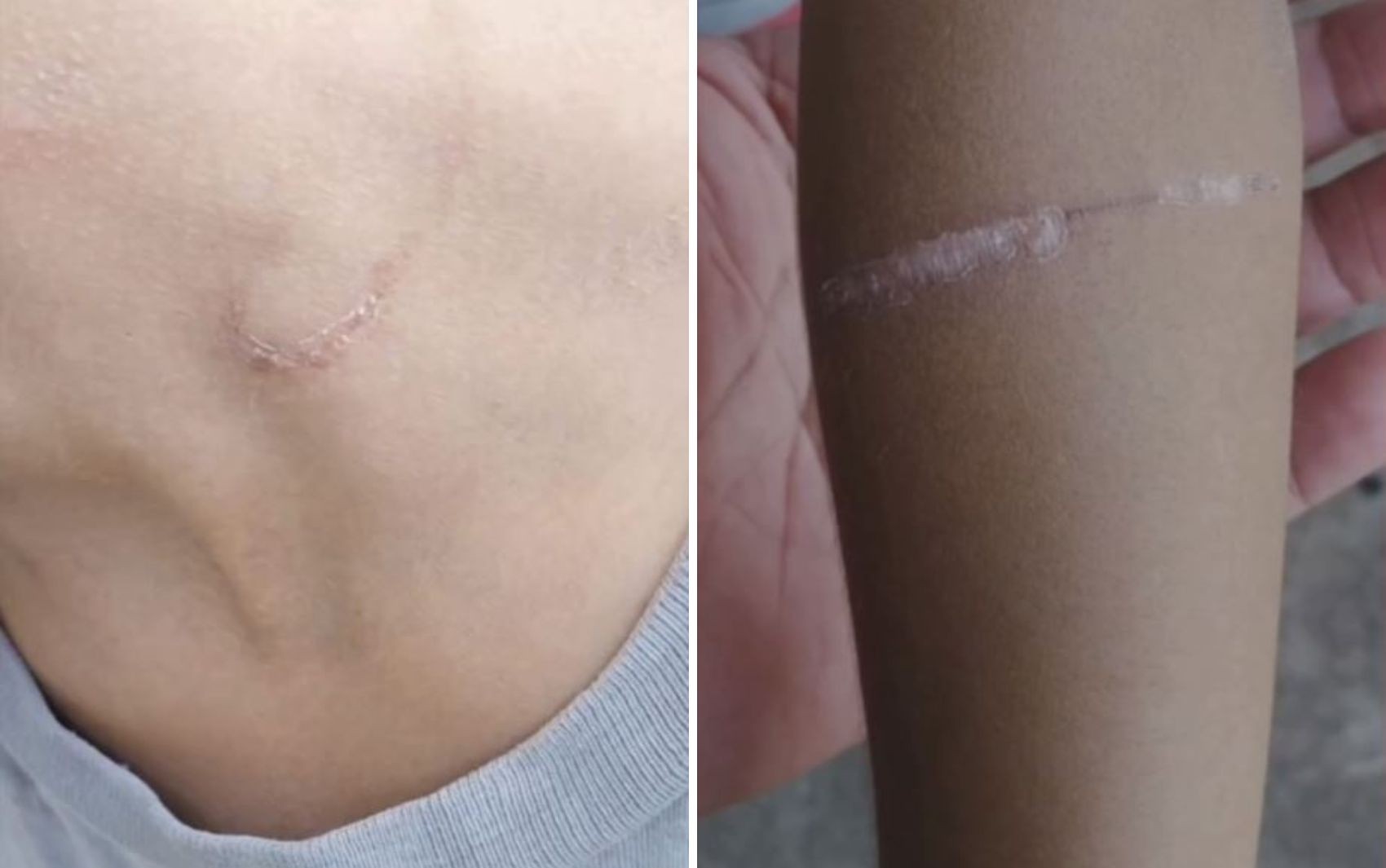 Pai é preso suspeito de torturar filhos de 7 e 8 anos; vídeo mostra ferimentos
