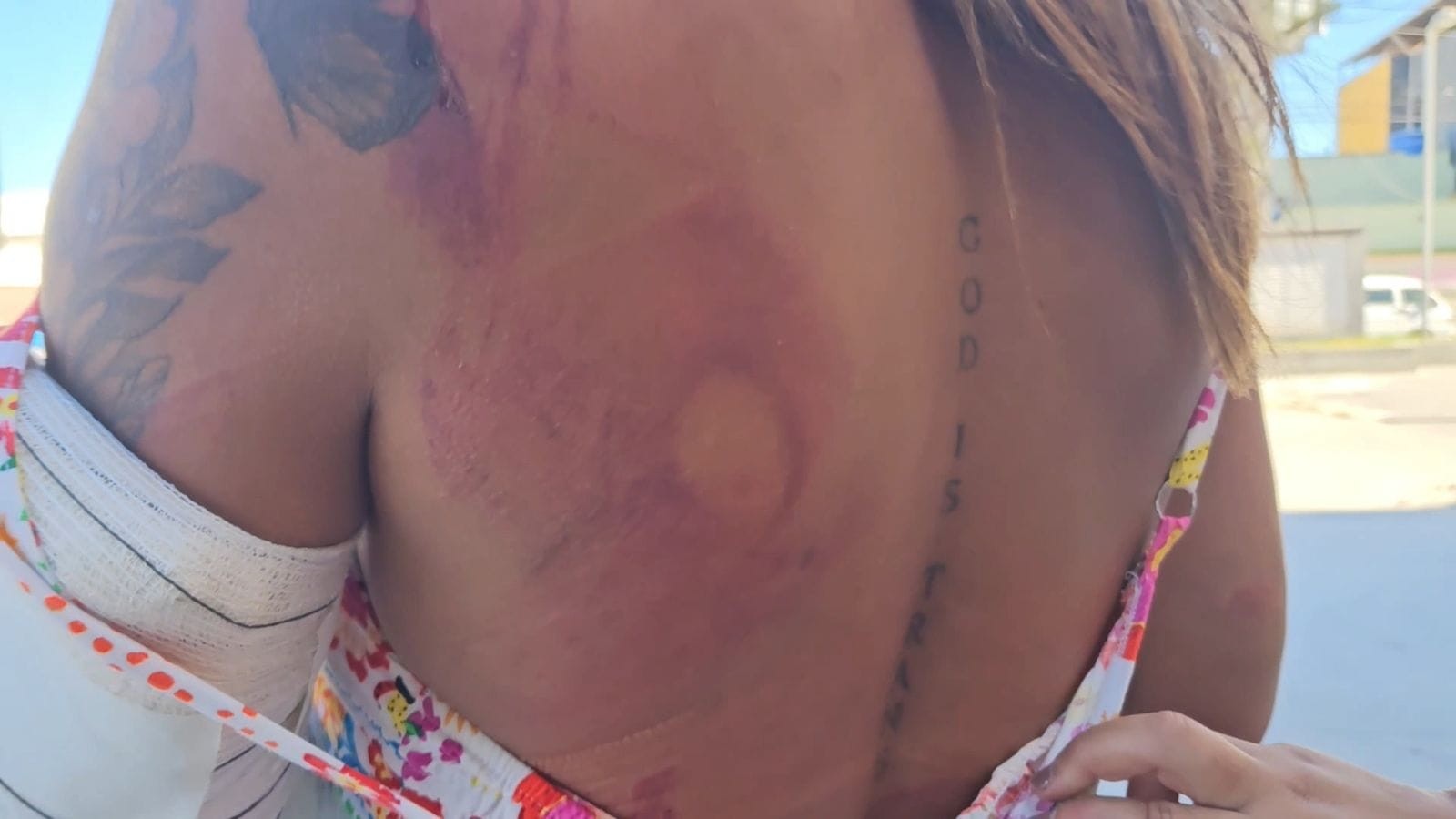 Mulher trans é agredida a pauladas por cinco homens na madrugada deste domingo em Cabo Frio