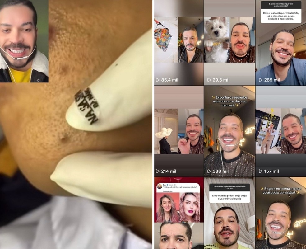 Dennis Sloboda parou de postar v&iacute;deos sobre cravos no TikTok &mdash; Foto: TikTok/Reprodu&ccedil;&atilde;o