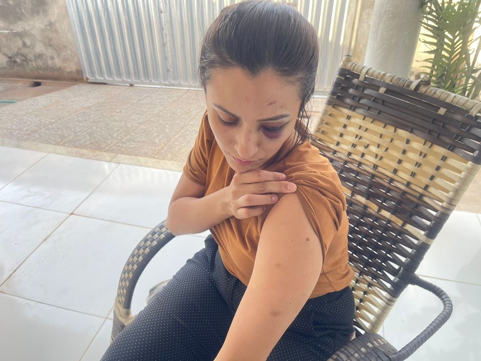 Enfermeira Carlene Nobre denuncia servidor do TJPI por violência doméstica — Foto: Christian Sousa /TV Clube