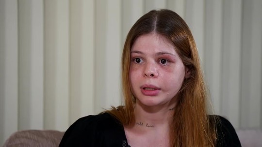 Fisiculturista que desfigurou médica a agrediu desmaiada por 6 minutos