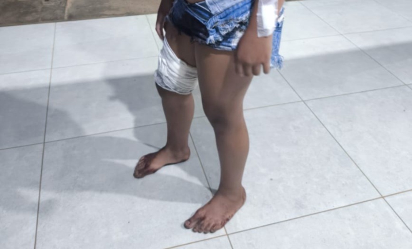 Adolescente é esfaqueada após esbarrar em mulher durante festa em MG