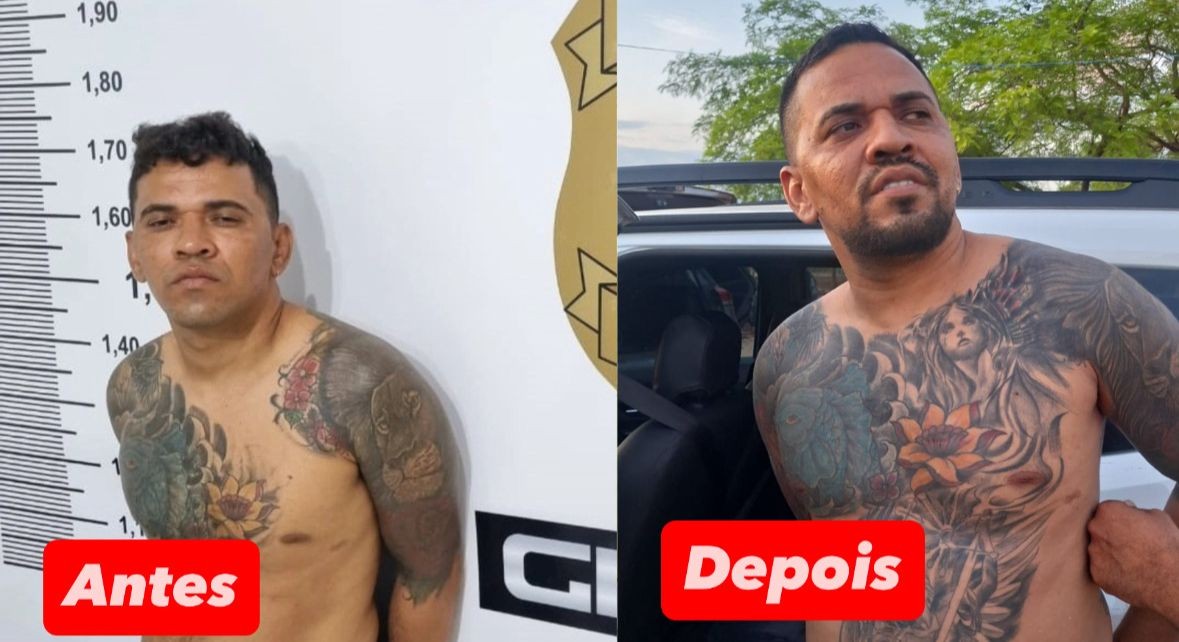 Veja antes e depois de chefe de facção procurado em 3 estados; ia a clínicas para mudar rosto, segundo a Polícia