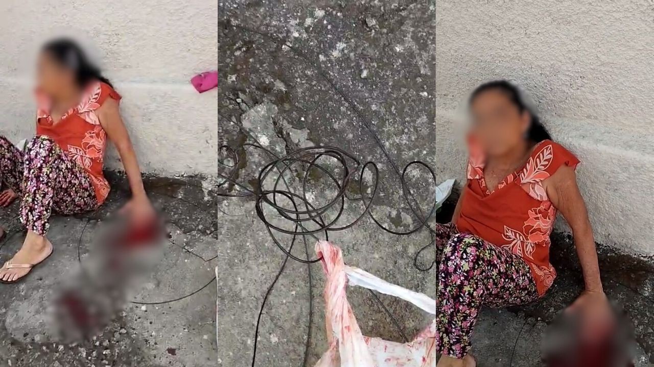 VÍDEO: Idosa tem pontas dos dedos decepados por fios pendurados em Divinópolis