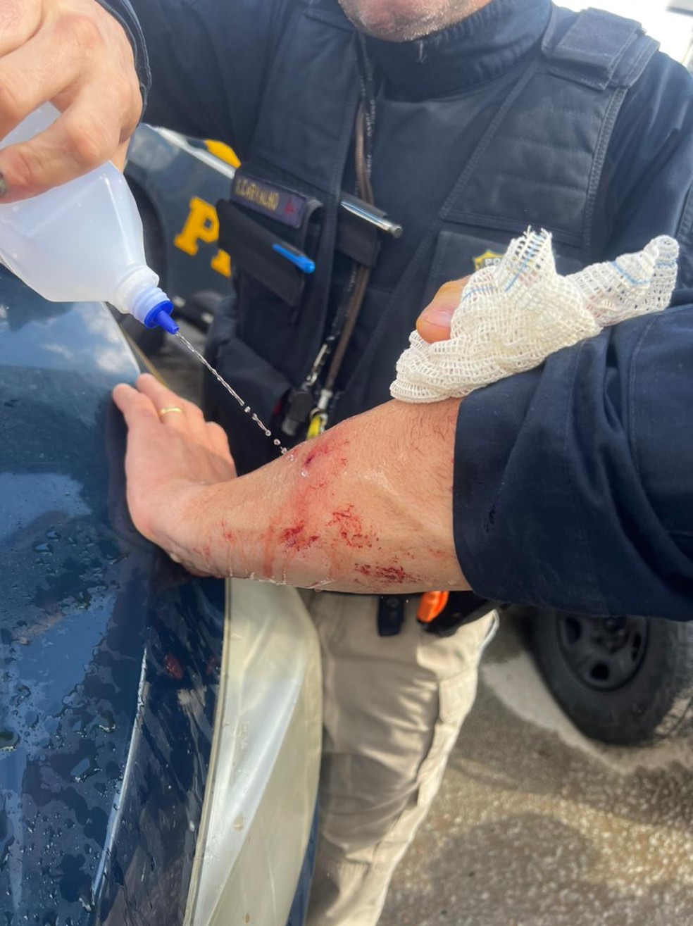 Braço ferido de policial agredido em bloqueio na BR-470 em Rio do Sul — Foto: PRF/Divulgação