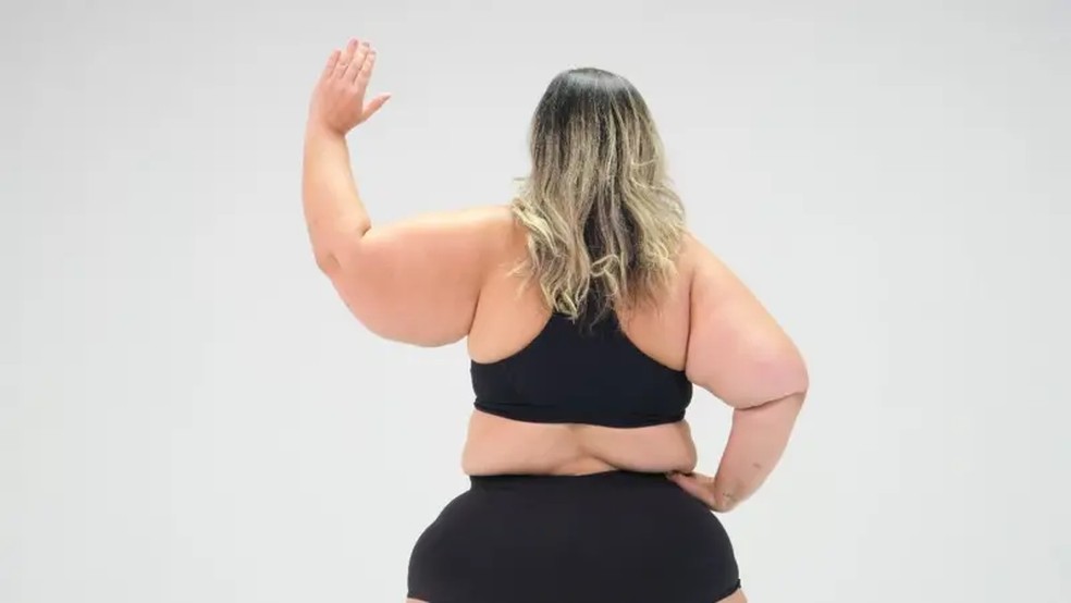 Mulher mostra braços afetados pelo lipedema — Foto: Crédito: ONG Movimento Lipedema