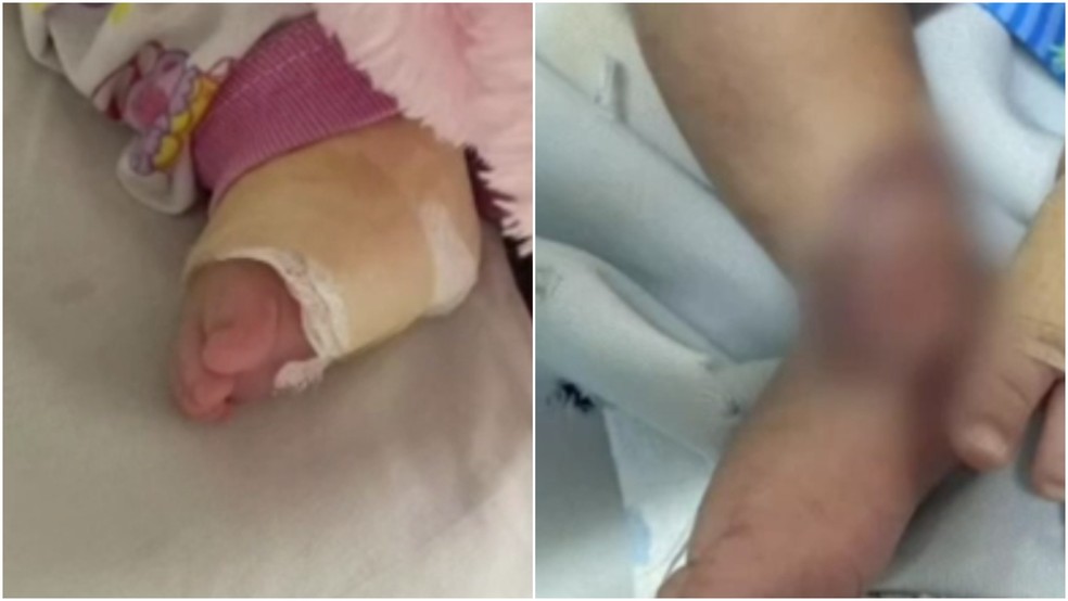 Bebê tem ferimento grave após injeção em hospital em Juazeiro do Norte — Foto: TV Verdes Mares/Reprodução