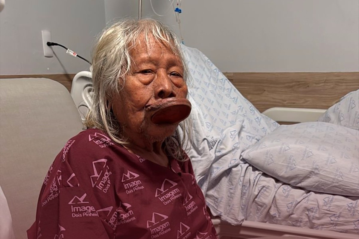 Cacique Raoni é diagnosticado com câncer aos 94 anos e recebe cuidados paliativos em MT