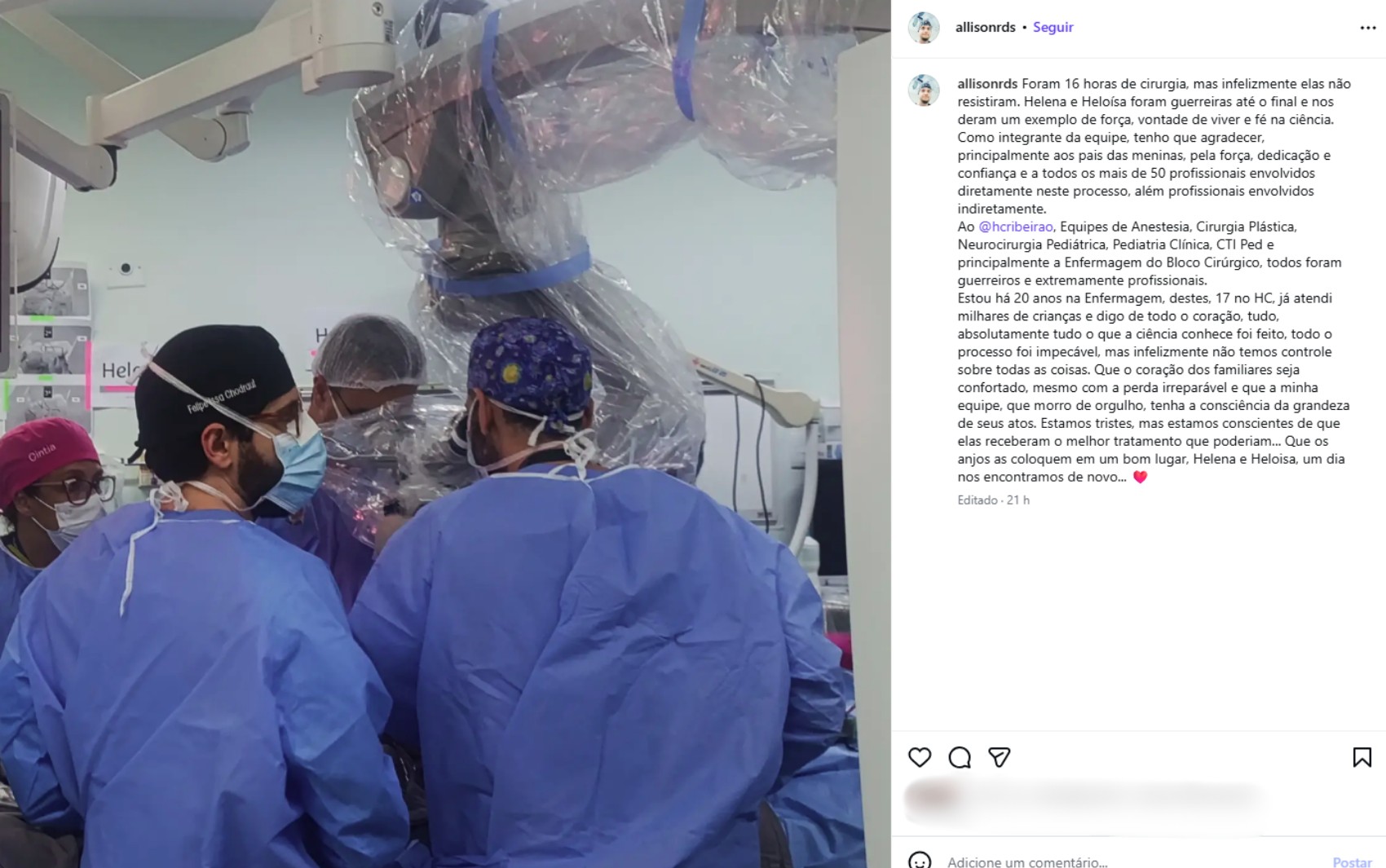 ‘Tudo o que a ciência conhece foi feito’, diz enfermeiro após morte de gêmeas unidas pela cabeça em cirurgia de separação no interior de SP