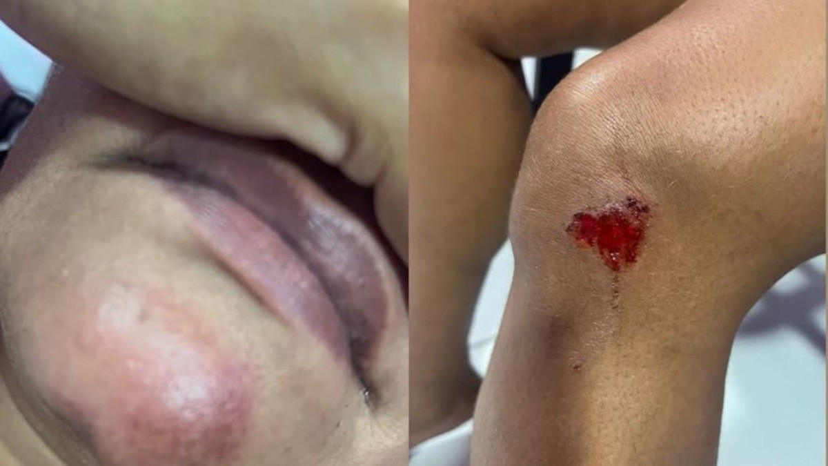 Homem arremessa companheira de carro em movimento, deixa mulher ferida e é preso em Maceió