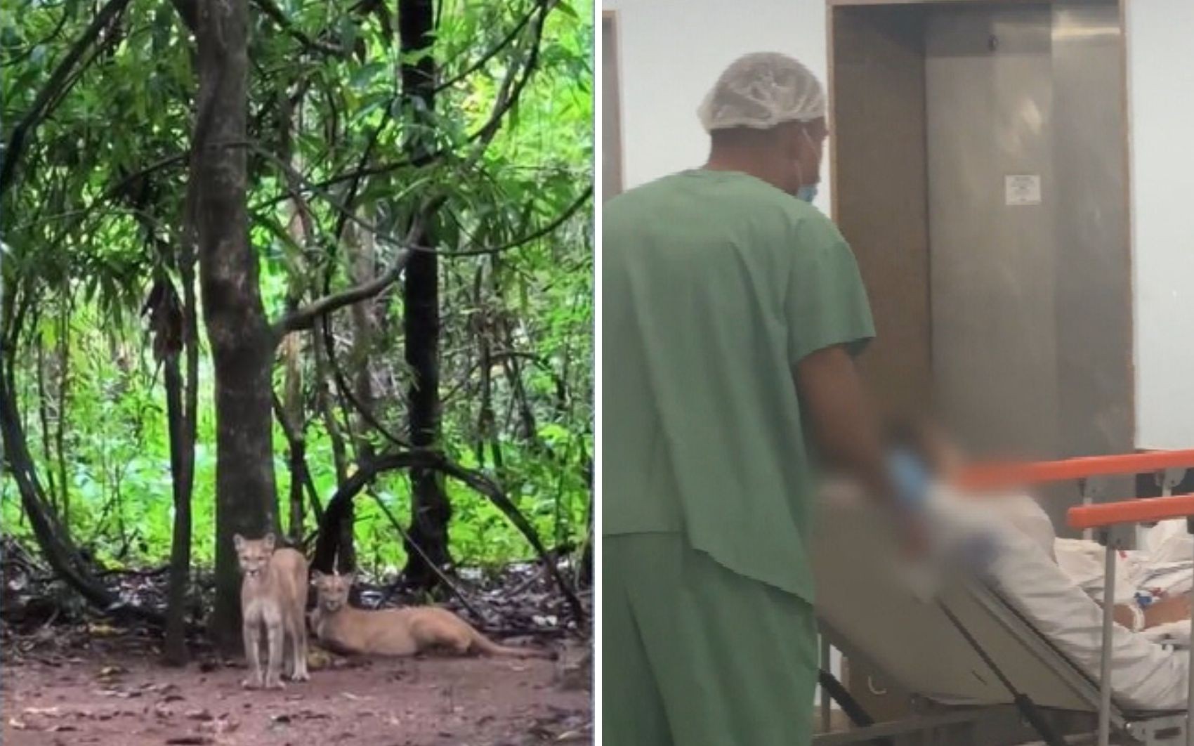 Menina atacada por onça durante trilha com a família não tem previsão de alta após cirurgia plástica no rosto