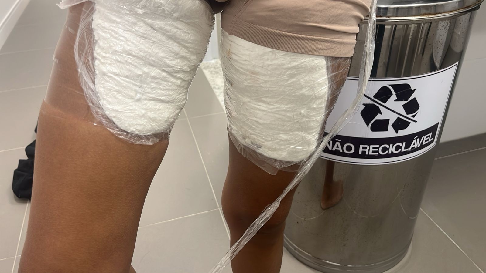 Mulher é presa no Aeroporto de João Pessoa com drogas coladas ao corpo 