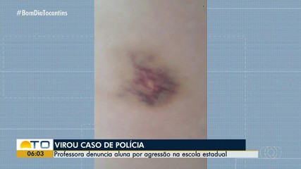 Professora denuncia aluna por agressão dentro de sala de aula em escola estadual de Guaraí