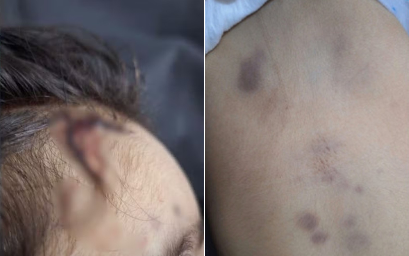 Casa foi lavada para tentar esconder sangue de menina morta após espancamento, diz delegado