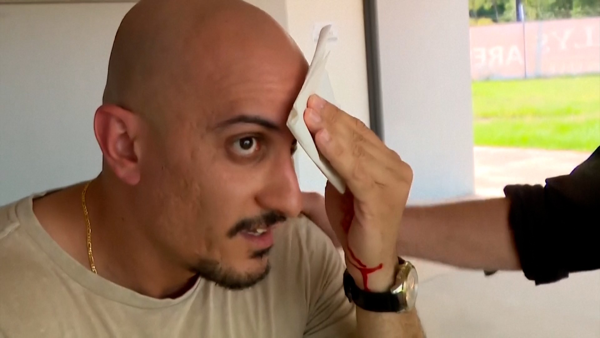 Líder da oposição na Austrália fere cinegrafista de TV acidentalmente; veja VÍDEO