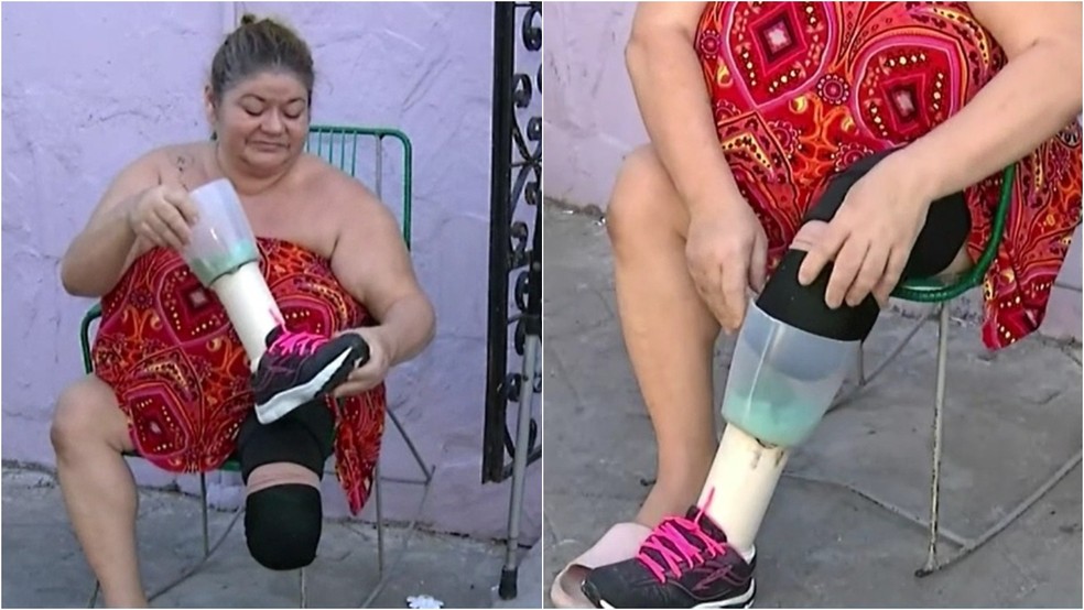 Dona de casa com câncer fez prótese com copo de liquidificador e cano para a perna amputada, na cidade de Sobral. — Foto: TV Verdes Marres/ Reprodução