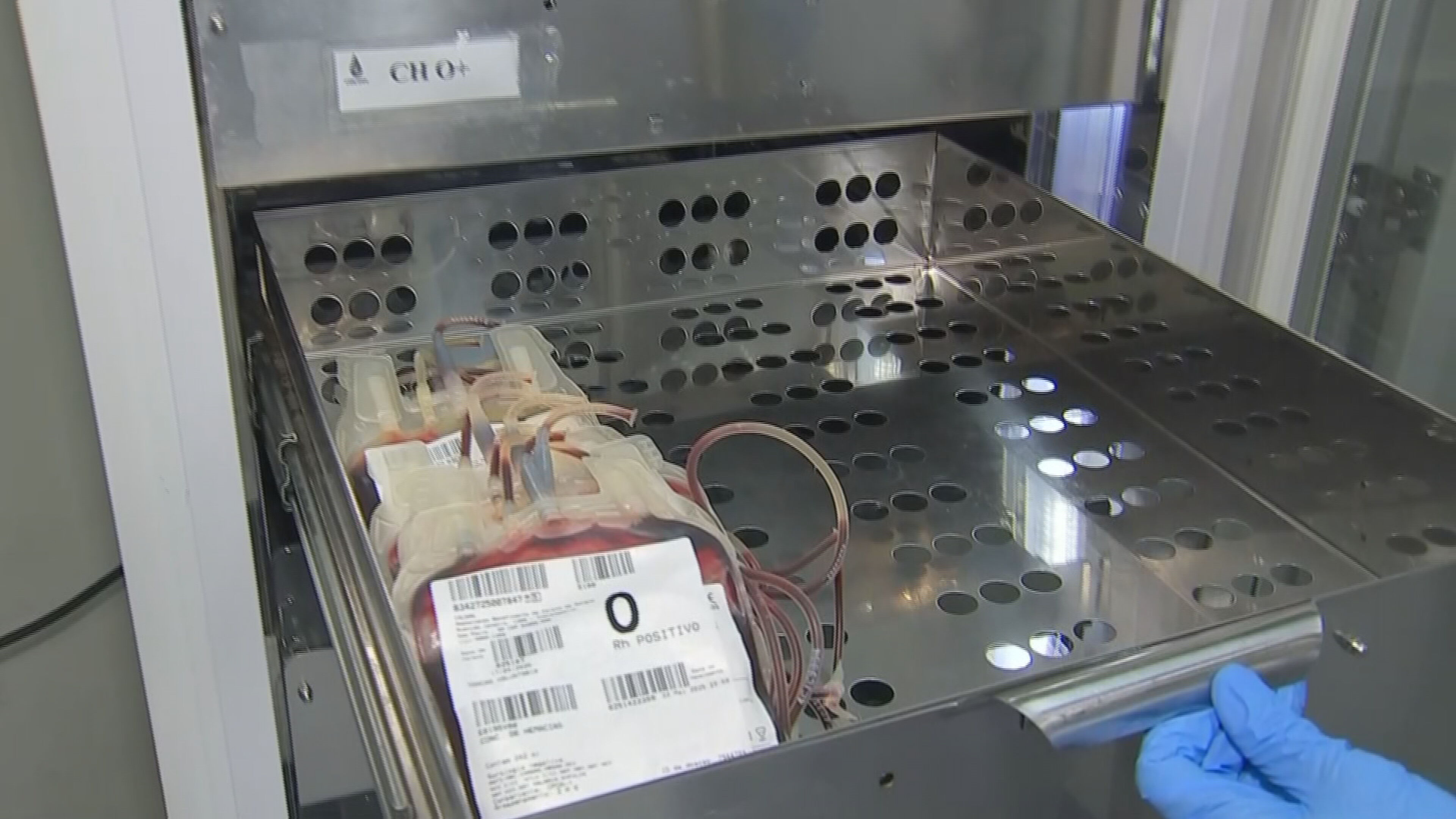 Queda nas doações de sangue pode impactar cirurgias em Sorocaba; saiba como doar