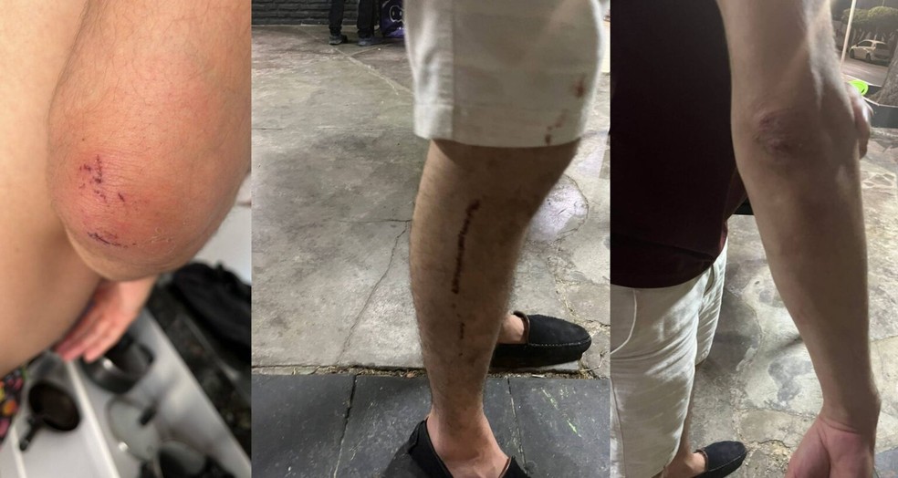Estudante de medicina é investigado após agredir casal gay e simular masturbação em bar — Foto: Divulgação