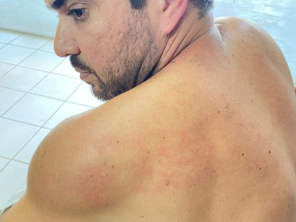 Vereador acusa parlamentar de agressão no Acre — Foto: Arquivo pessoal, Paulo Miranda