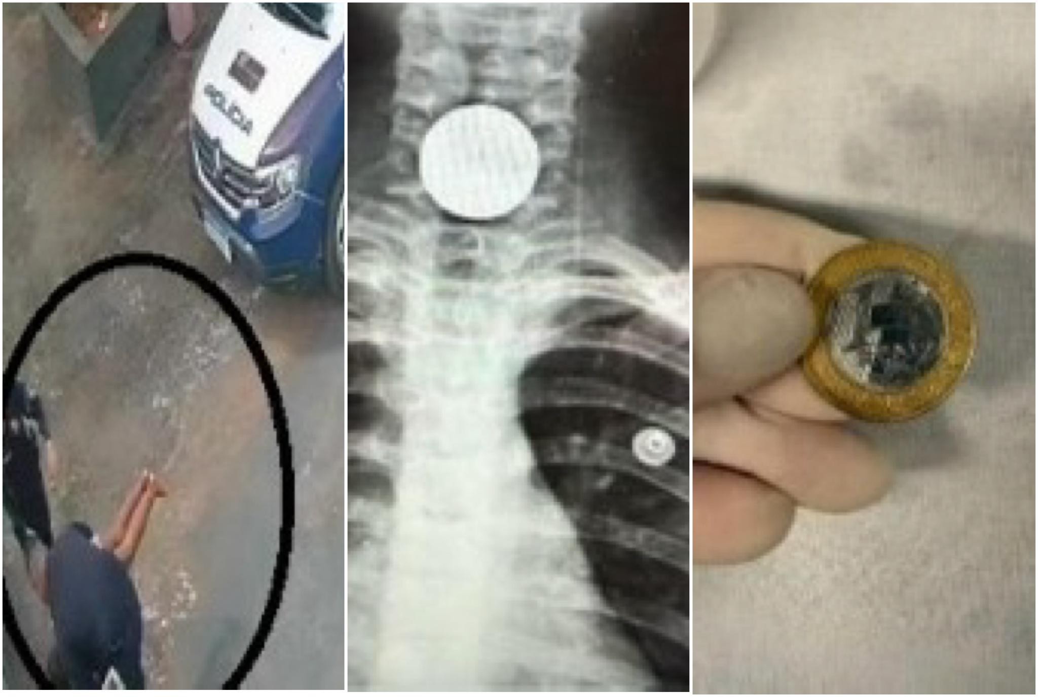 Vídeo: menina de 7 anos se engasga com moeda e é socorrida por policiais em MT