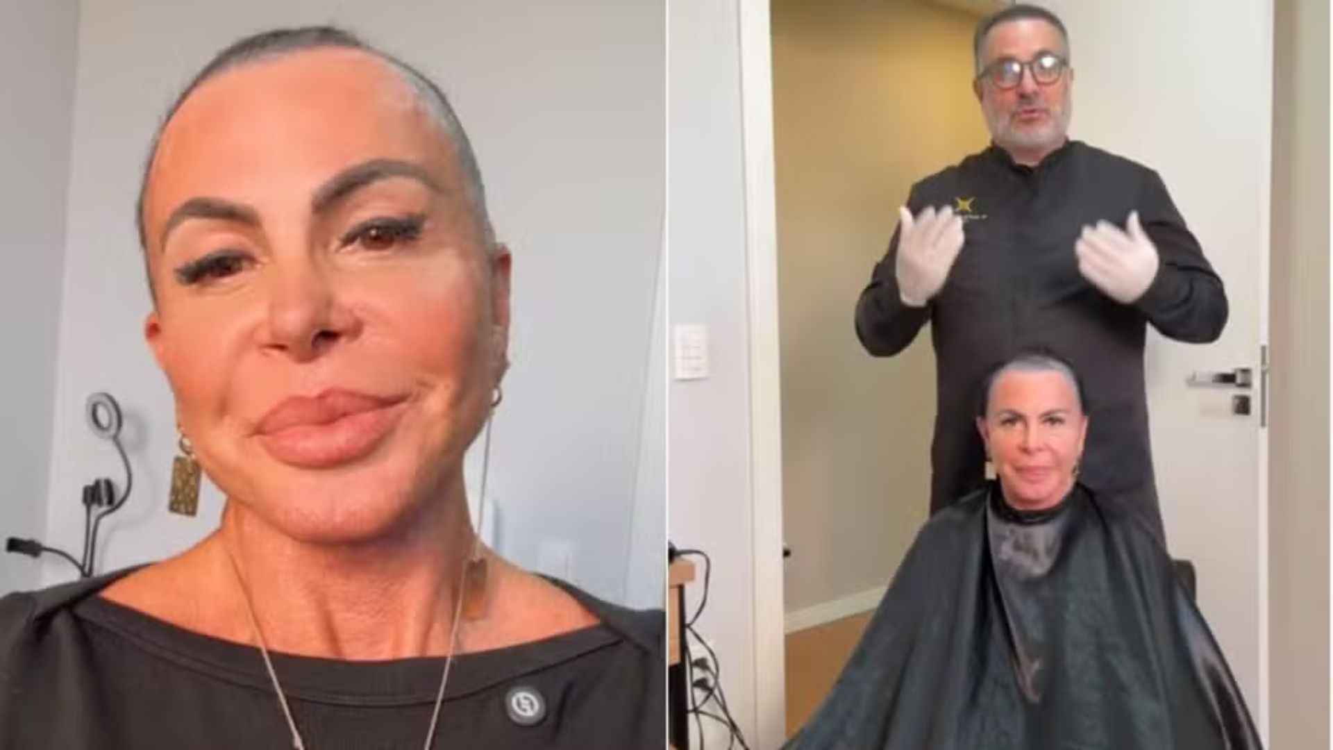 Gretchen passa por transplante capilar em Vitória