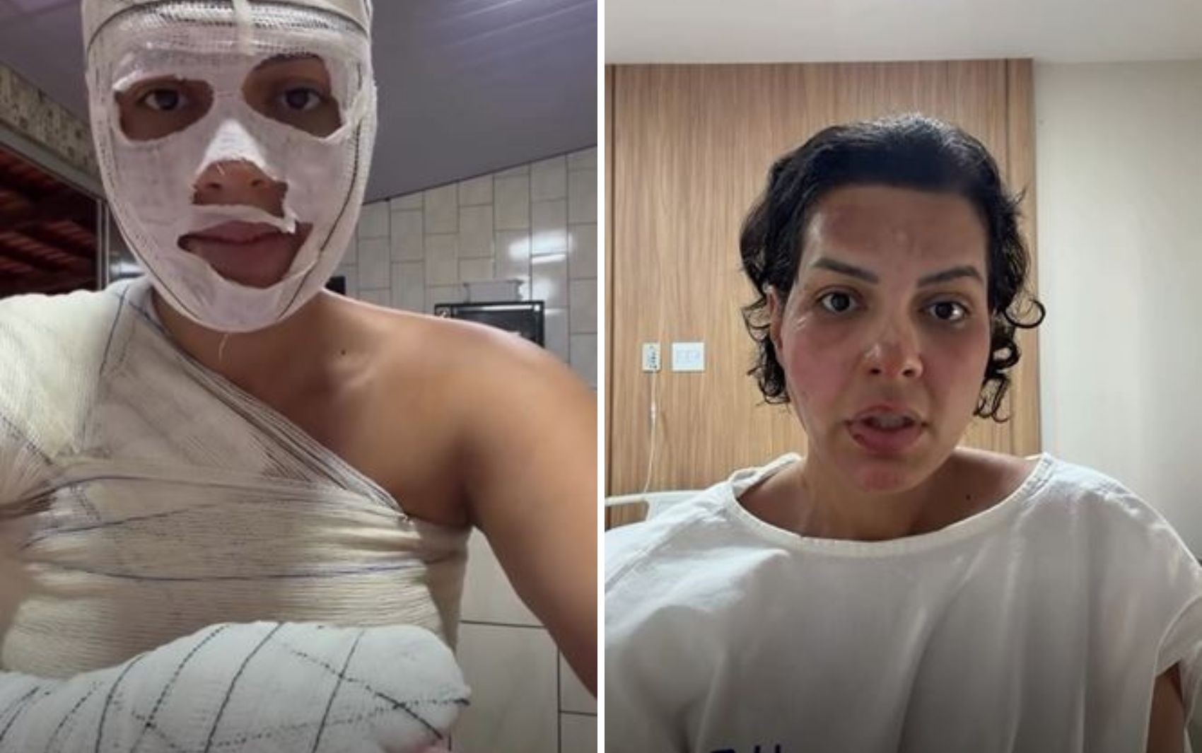 Nutricionista sofre queimaduras graves durante faxina na casa da mãe e faz alerta