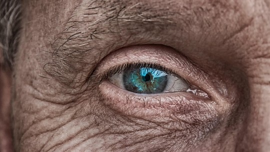 Estudos indicam que é seguro fazer cirurgia de catarata em ambos os olhos no mesmo dia - Congresso internacional também discutiu a condição conhecida como olho seco, bastante comum após os 50 anos.