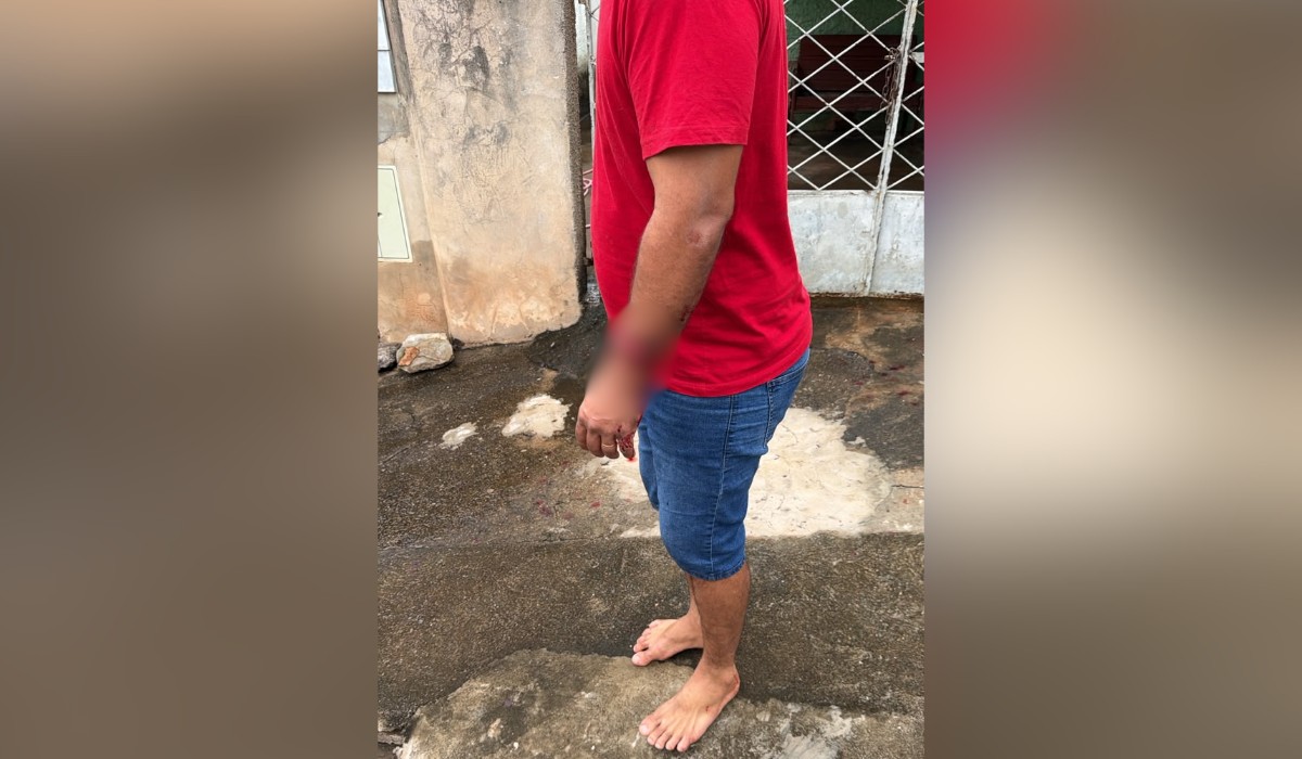 Ataque de pitbulls deixa irmãs feridas e um dos cães morre após intervenção policial no interior de SP