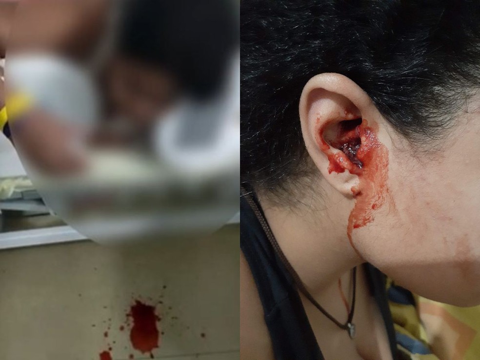 Jovem de 17 anos est internada na Santa Casa de Santos, no litoral de So Paulo, por sangramentos no nariz, boca e ouvidos  Foto: Arquivo pessoal