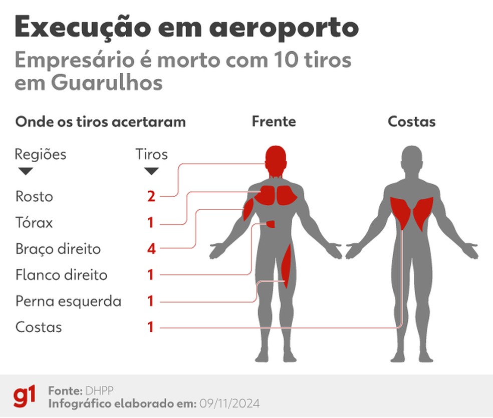 Infográfico mostra áreas do corpo de Antônio Vinicius Gritzbach atingidas por tiros — Foto: g1