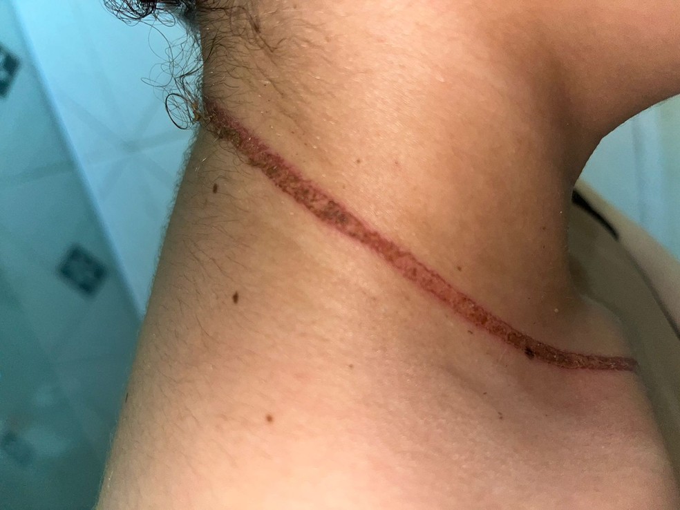 Jovem mostra ferimento ap&oacute;s o ocorrido na madrugada deste domingo (28) &mdash; Foto: Arquivo pessoal