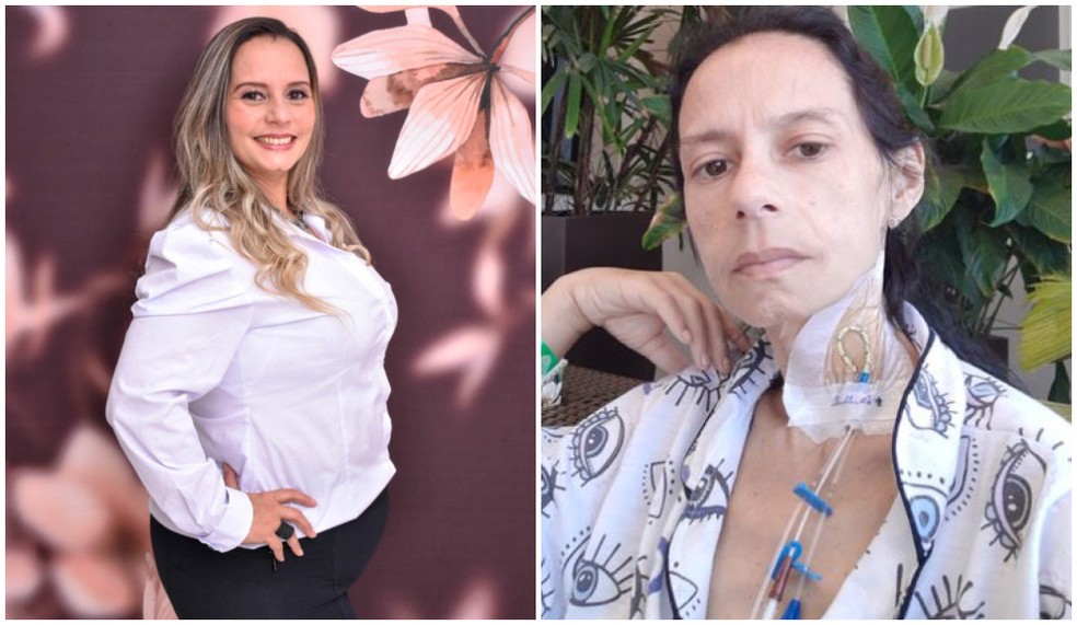 Ana Paula da Costa Santana passou da obesidade para anemia extrema após fazer cirurgia barátrica — Foto: Arquivo pessoal