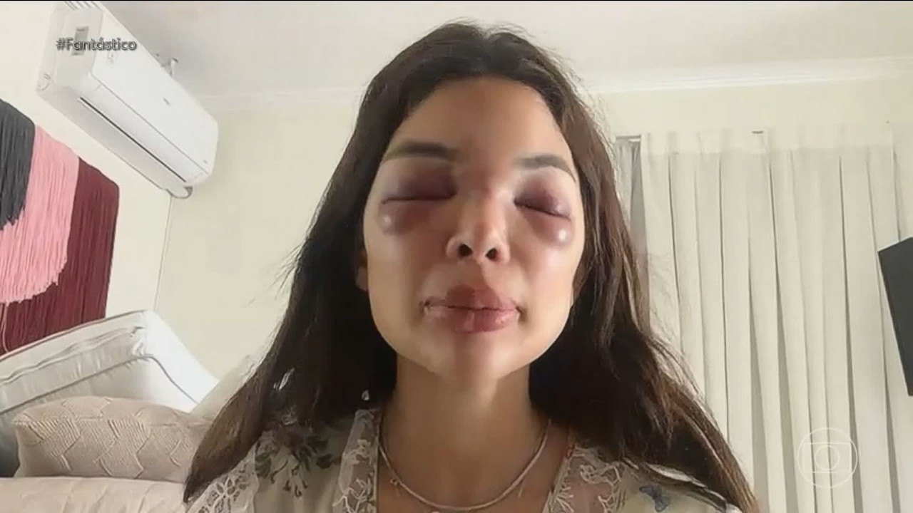Vídeo mostra momento em que dentista é agredida por empresário da Faria Lima; vítima relata episódio: 'ele vai me matar'