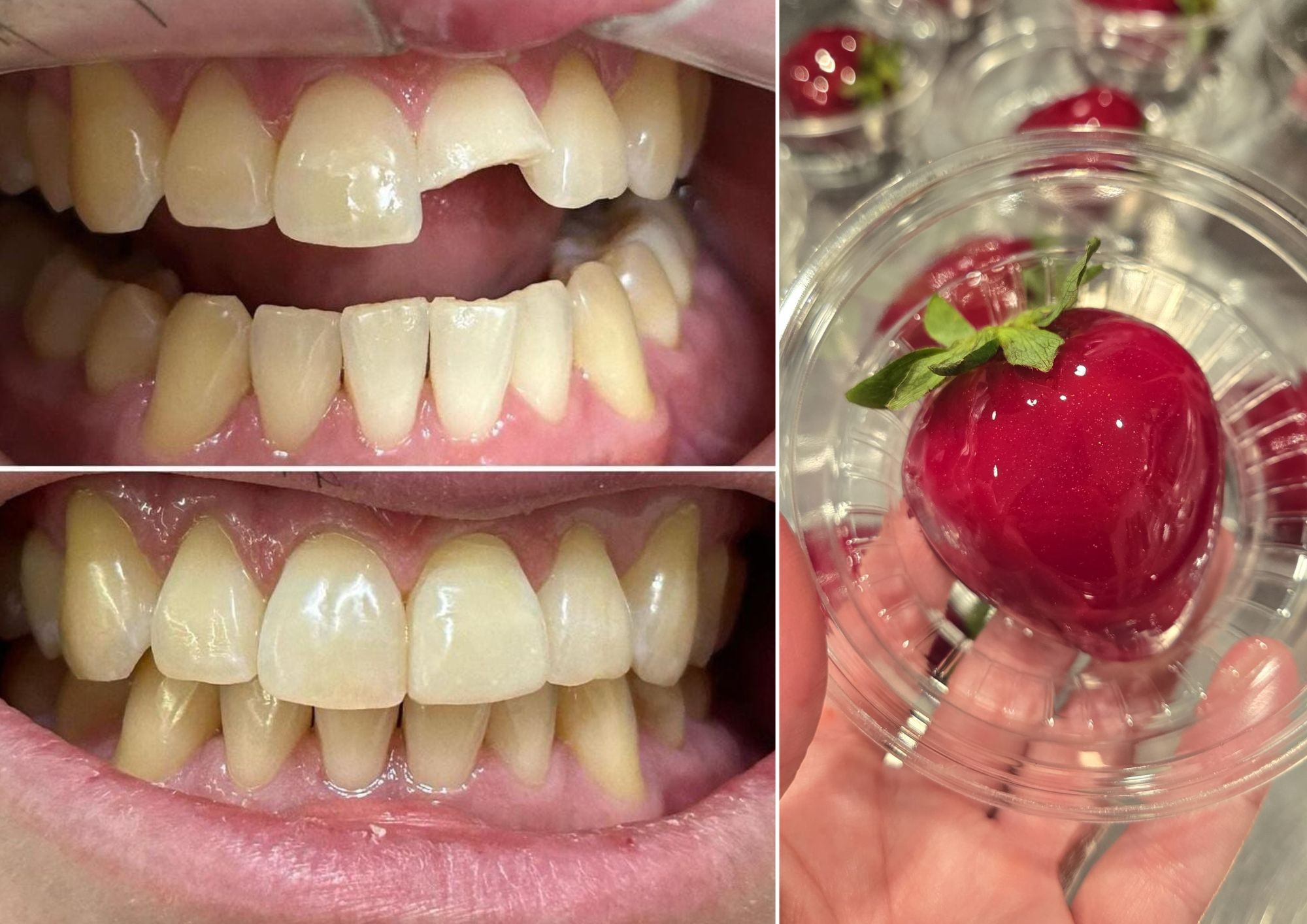 'Morango do Amor' causa fraturas dentárias e dentistas alertam: 'Bomba de açúcar'