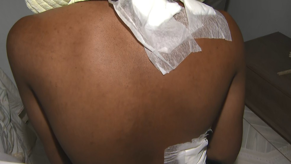 Mototaxista é esfaqueado por homem que fingiu ser cliente para cometer assalto na Bahia — Foto: TV Bahia