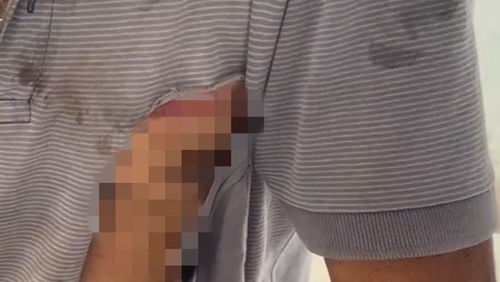 Idoso é agredido com socos e tiro no rosto após reclamar de som alto da casa de vizinho no interior do MA — Foto: Reprodução/Redes sociais