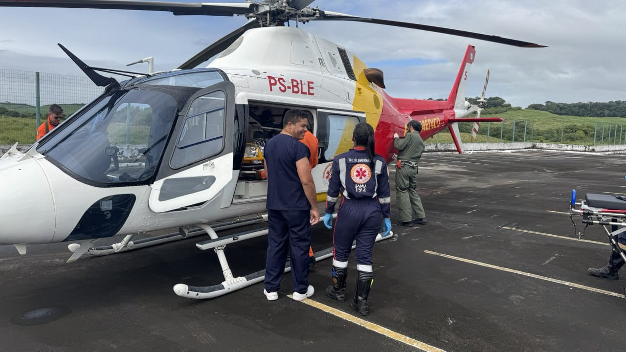Estudante fica gravemente ferida após sofrer queimaduras ao ser atingida por fio elétrico em Alagoas