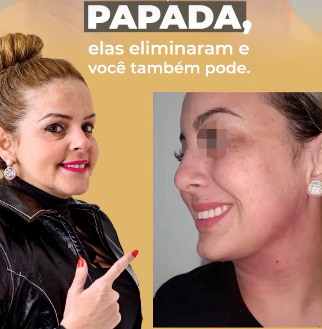 Dentista vira ré por morte de paciente após procedimentos estéticos no Rio