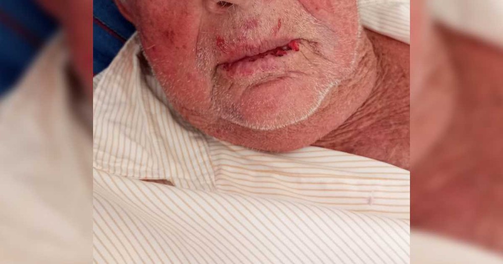 Aposentado de 83 anos foi agredido por criminosos que invadiram e roubaram sua casa — Foto: Reprodução