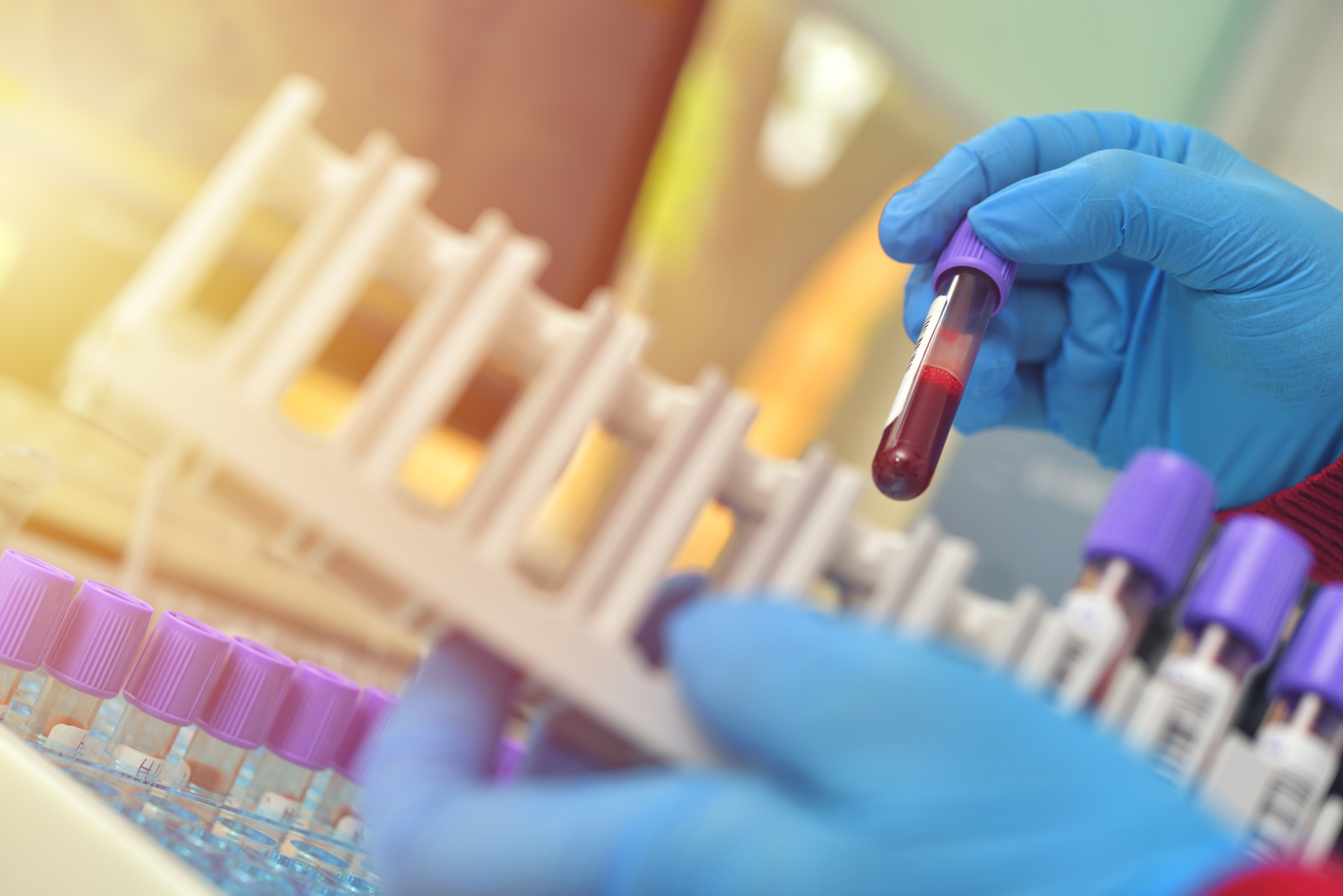 Pesquisa com mais de 28 mil pessoas descobre 'freio' que pode ser chave para novos tratamentos de doenças hereditárias do sangue