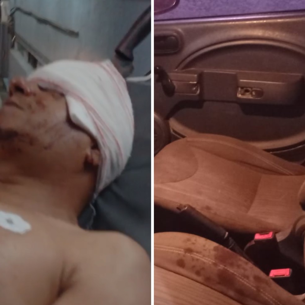 Homem tem cabeça perfurada por faca após tentativa de roubo — Foto: Reprodução