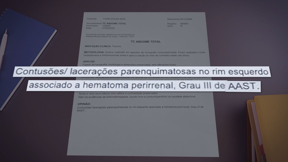 Laudo mostra contusões sofridas por adolescente agredido por amigo em escola particular do DF — Foto: Reprodução