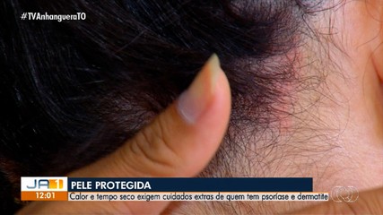 Calor e tempo seco exigem cuidados extras com a pele