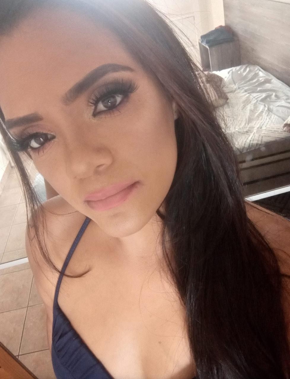 Balconista perde movimentos, visão e fala após cirurgias plásticas, e Polícia Civil investiga o caso